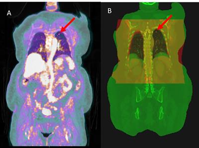 DAART: a deep learning platform for deeply accelerated adaptive radiation therapy for lung cancer